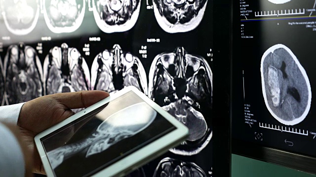 医生诊断用x光图像的数字平板电脑视频素材