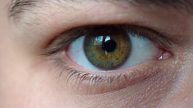 一个年轻人眨眼的彩色异色眼睛的特写。视频下载
