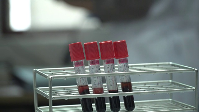 血液在实验室视频素材