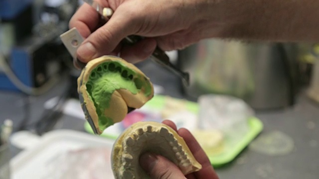 牙医开牙印模装置视频素材