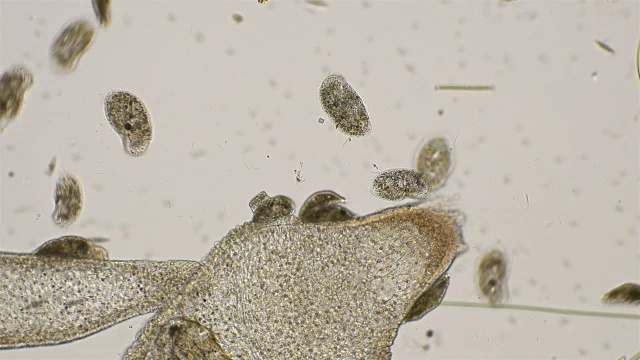 在显微镜下注射木霉素和木蠹杆菌视频下载