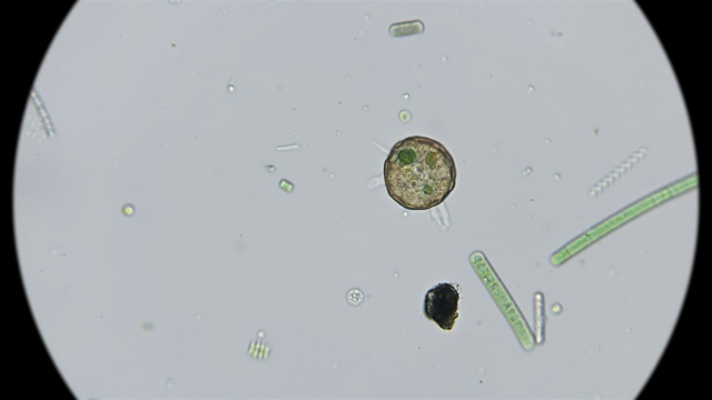 在显微镜下观察gibbosa阿赛拉变形虫的状态视频素材