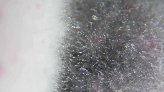 在显微镜下，从腐烂的醋栗上取下的霉菌。浆果果酱上的霉菌孢子菌落。过敏、中毒、真菌。白色霉菌菌落的抽象纹理。关闭了。Closeup.4K UHD视频素材