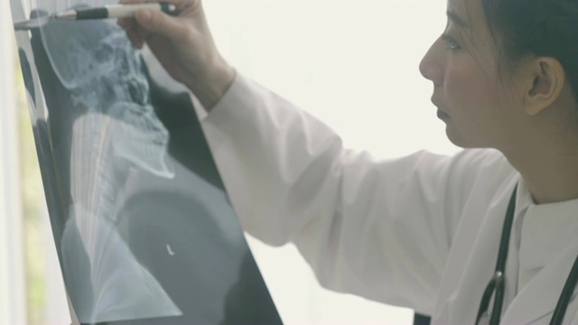 亚洲女医生在x光片上检查颅骨扫描视频素材