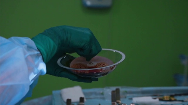 外科医生为手术准备乳房硅胶植入物视频素材