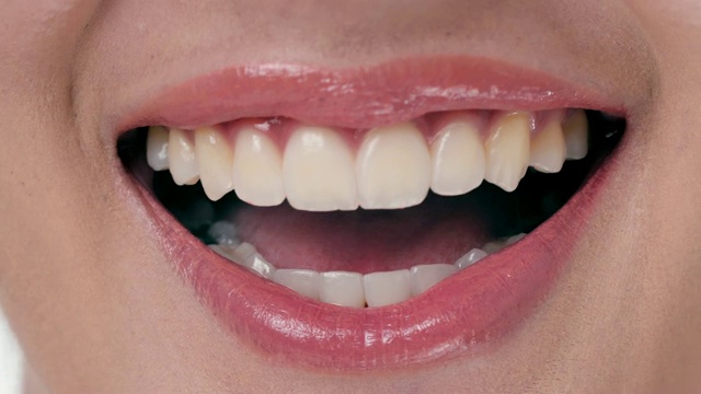 微笑女人的特写。牙科检查视频素材
