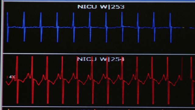 新生儿重症监护室心电图的关闭;红色和蓝色。视频素材