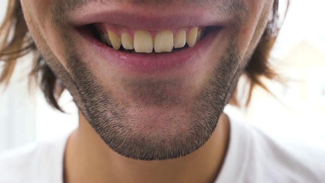 一个微笑的牙齿孤立的白色背景的特写。视频下载
