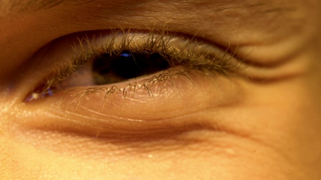 视力差的年轻人，眯眼，眼科，极端近距离观察视频下载