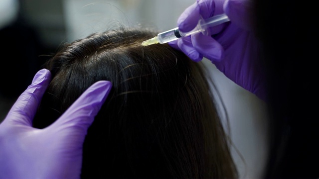 一位美丽的年轻女子在美容医学中心接受头部注射。视频素材