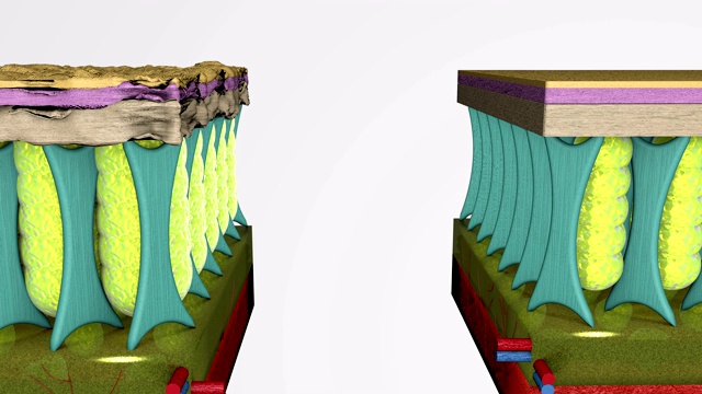 三维动画结构比较正常皮肤组织层和与脂肪团。视频下载