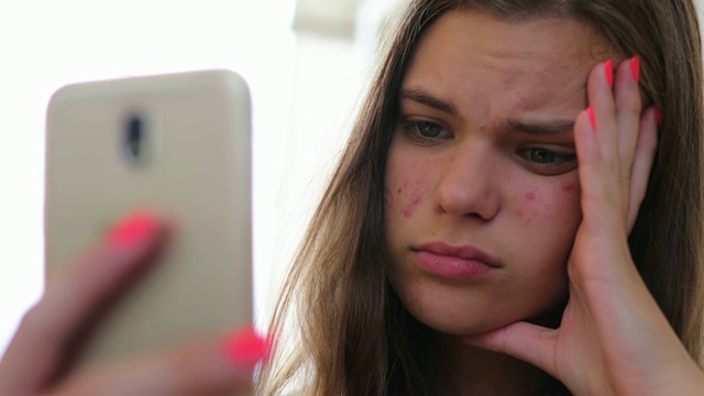 年轻的女孩看着她的手机前摄像头，她为她的痤疮问题感到难过视频下载