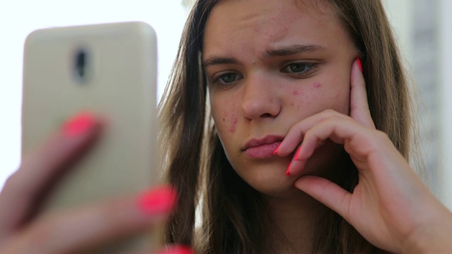 年轻的女孩看着她的手机前摄像头，她为她的痤疮问题感到难过视频素材