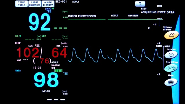 手术室心脏监护仪的关闭。心电监护仪显示患者的心率背景视频素材