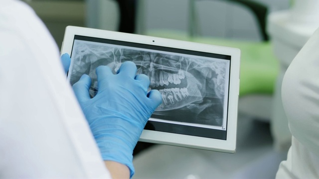 牙医在数字平板电脑上看人类牙齿的x光视频下载