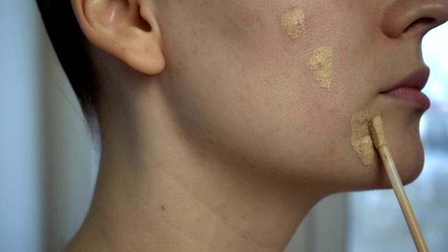近距离观察皮肤问题(不健康的皮肤如痤疮和丘疹)。遮盖问题皮肤。视频素材