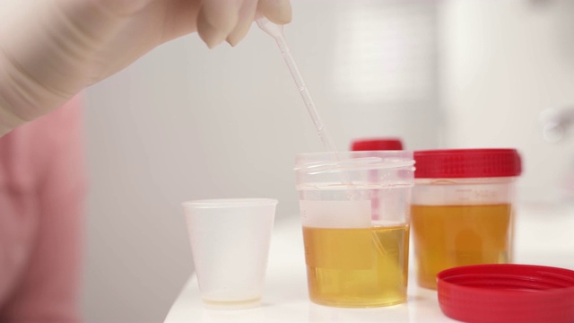 从容器中取出尿液样本并将其从移液管中倒入塑料杯的演示视频。视频素材