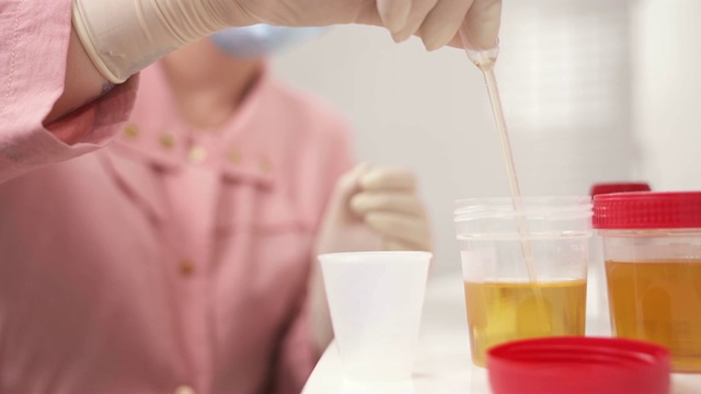 临床实验室科学家用移液管抽取尿液样本并将其放入塑料杯的演示视频。视频素材