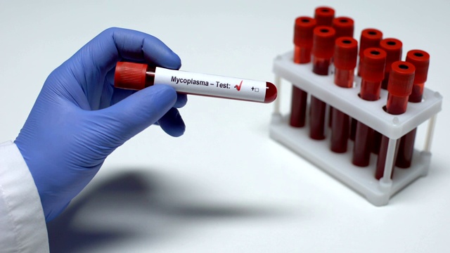 支原体检测阴性医生提供血样实验室研究保健视频下载