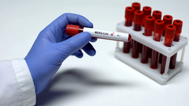 MERS-CoV检测阴性，医生在试管中发现血液样本，健康检查视频素材