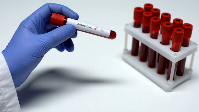 腺病毒试验阴性，医生在试管中显示血液样本，实验室研究视频素材