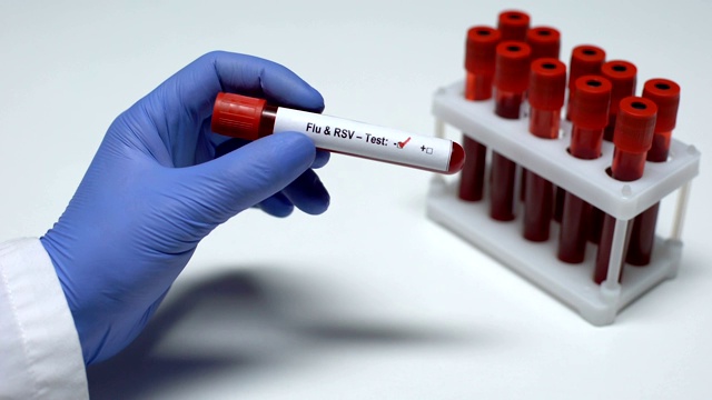 流感病毒检测阴性，医生提供血样，实验室研究，健康检查视频素材