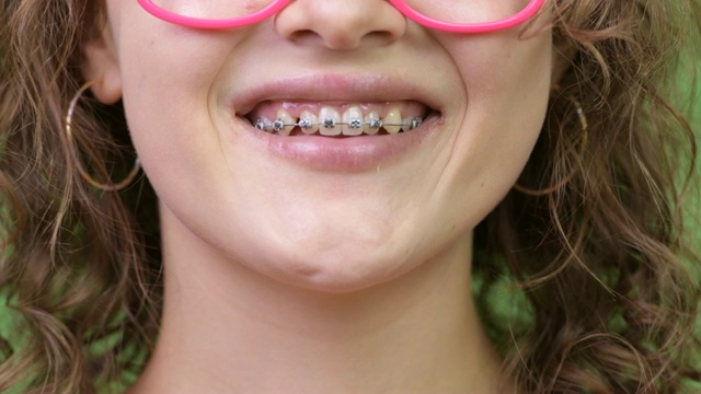 微笑的快乐年轻的书呆子女人带着牙套微笑视频素材