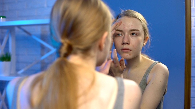 年轻女性用遮瑕膏遮盖面部问题肌肤，皮肤科治疗视频素材