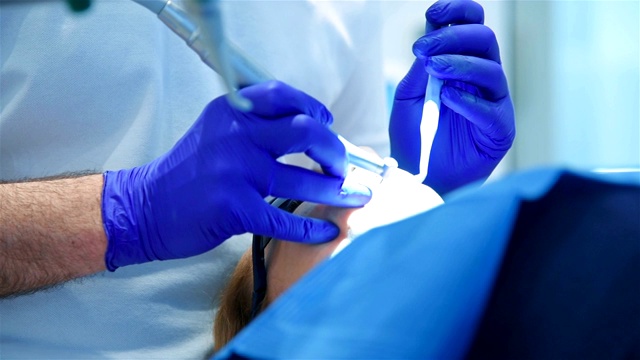 牙医进行医疗手术视频素材