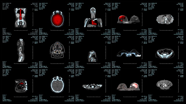 医院MRI检查显示多个图像视频下载