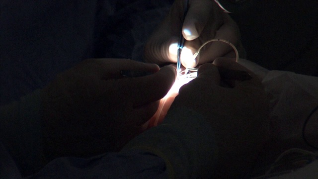 外科手术医院手术室里的外科手术视频素材