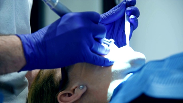 牙医进行医疗手术视频素材