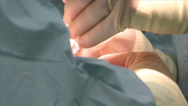 手术室里的外科医生视频素材