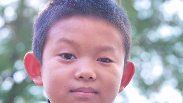 特写亚洲男孩的脸。左眼是看不见的残疾。慢动作视频下载