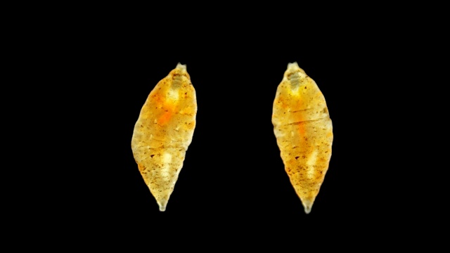 在显微镜下，在土壤中发现了蠕虫状的昆虫幼虫视频素材