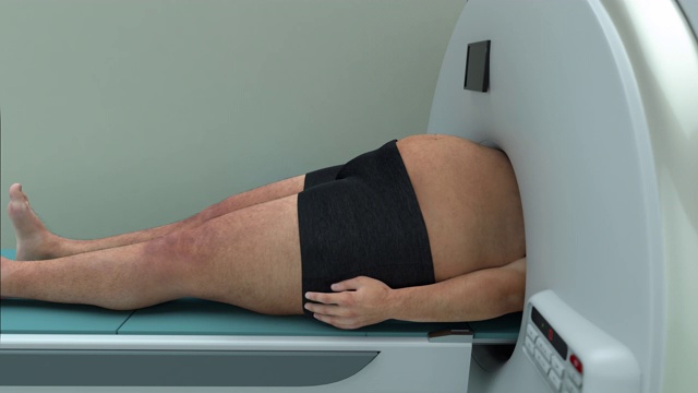 肥胖——人被困在核磁共振机器里视频素材