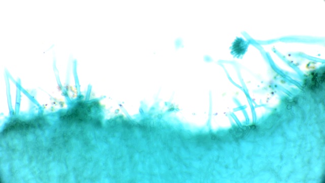 曲霉菌显微镜观察视频下载