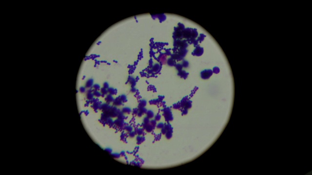 在显微镜下观察葡萄球菌。厌氧生物样本。实验室研究的概念视频下载