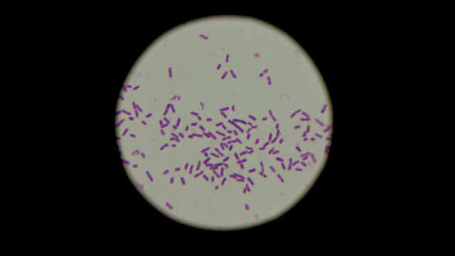 显微镜下念珠菌孢子的特征。实验室和医学研究概念。视频下载