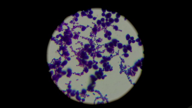 在显微镜下观察葡萄球菌。实验室研究的概念。焦点改变拍摄视频下载