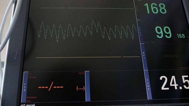 心电图的显示，病人心跳和血压的电活动图，心电图或心电图屏幕上的图表。婴儿heartbeat.4k。4 k的视频视频素材