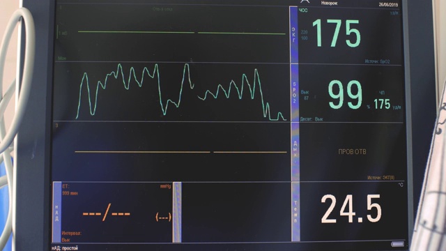 心电图的显示，病人心跳和血压的电活动图，心电图或心电图屏幕上的图表。婴儿heartbeat.4k。4 k的视频视频素材