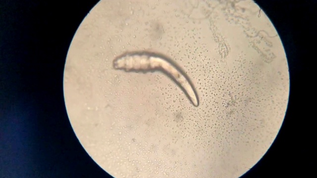 螨虫在显微镜视频下载