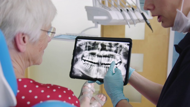 牙科医生向年长病人出示化验结果视频素材