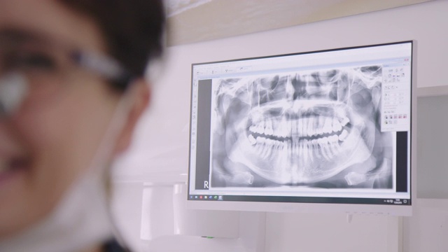 微笑的牙医对医疗x光的特写视频素材