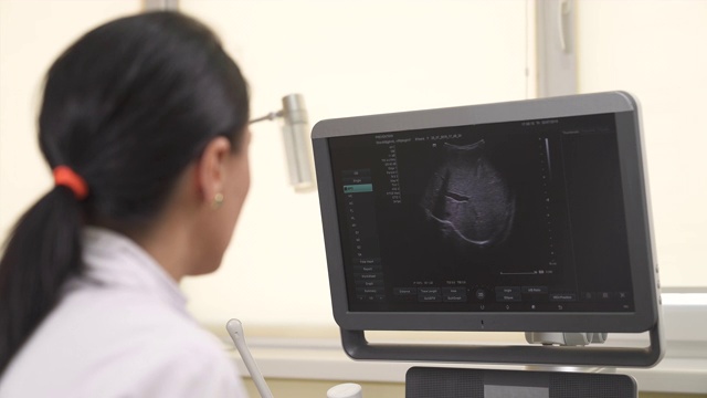 一个专业女医生的特写看着医疗机器的监视器，同时进行超声波检查。医疗保健的概念视频素材