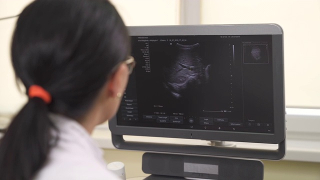 一个特写的专业女医生看着超声波机器监视器，同时做医学检查。医疗保健的概念视频素材