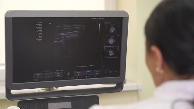 一个专业女医生做腹部超声检查的特写。肠子在监视器。医疗保健的概念视频素材