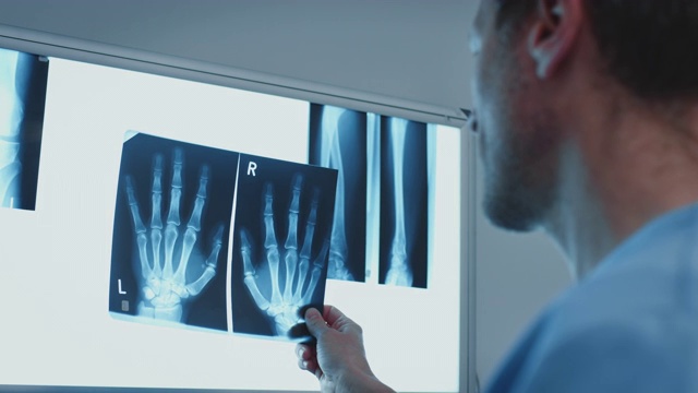 外科医生指着医用x光片上的手指视频下载