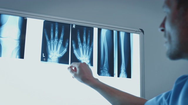 外科医生分析手指关节影像结果视频下载
